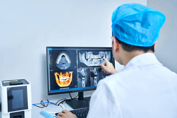 Best Emergency Wisdom Teeth Removal in Durand, MI